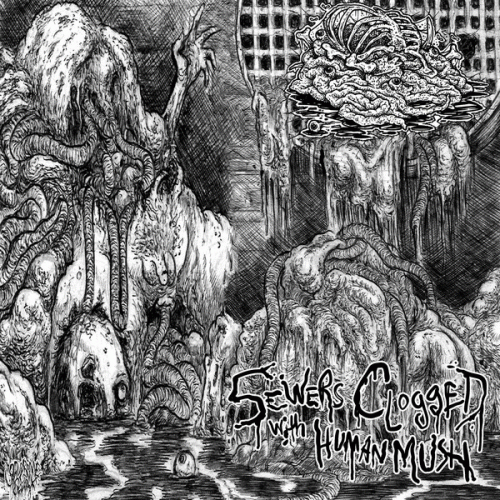 Botched Anastomosis J-Pouch : Sewers Clogged with Human Mush